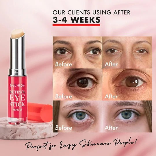 Krem pod oczy z retinolem w sztyfcie EELHOE Stick™