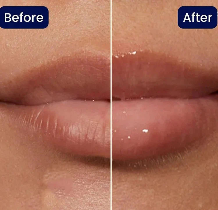 KissBeauty™ Natychmiastowy powiększony balsam do ust