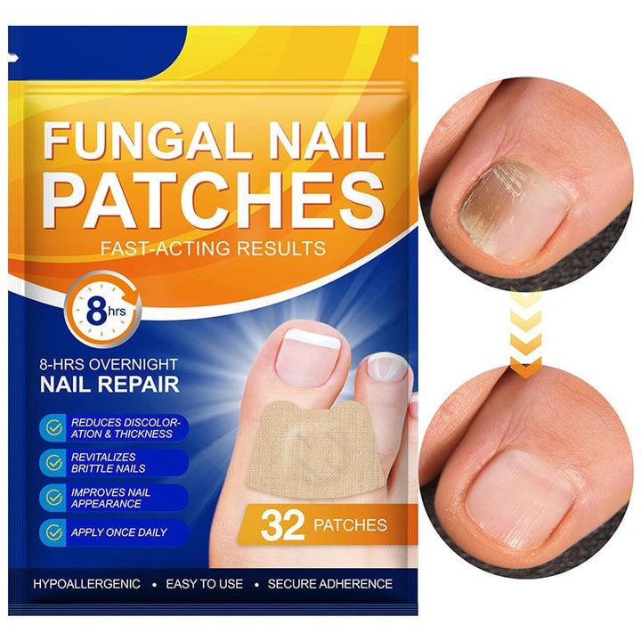 NailNex™ skuteczne leczenie grzybicy paznokci